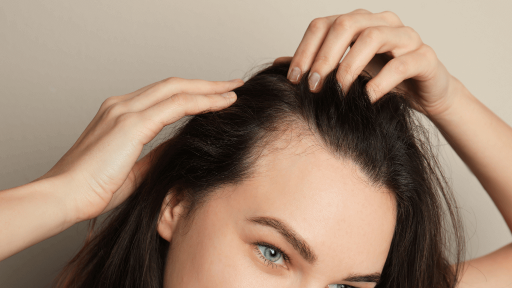 Female Hair Loss Treatment